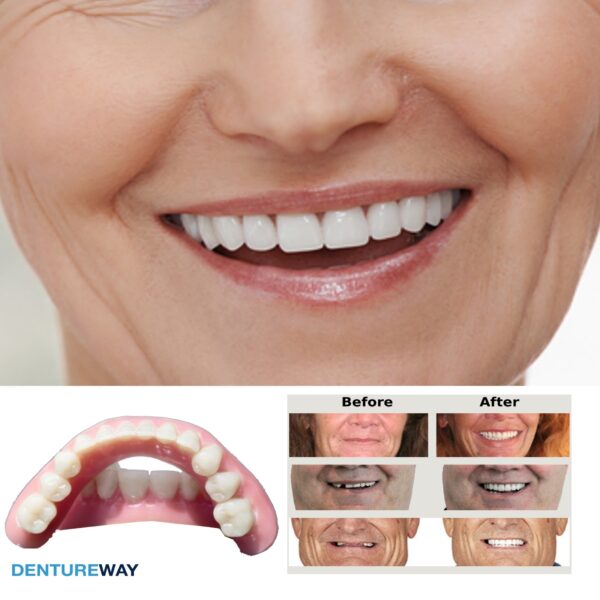 Diy denture kit regain your smile