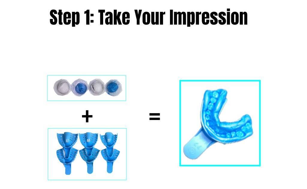 Impression kit