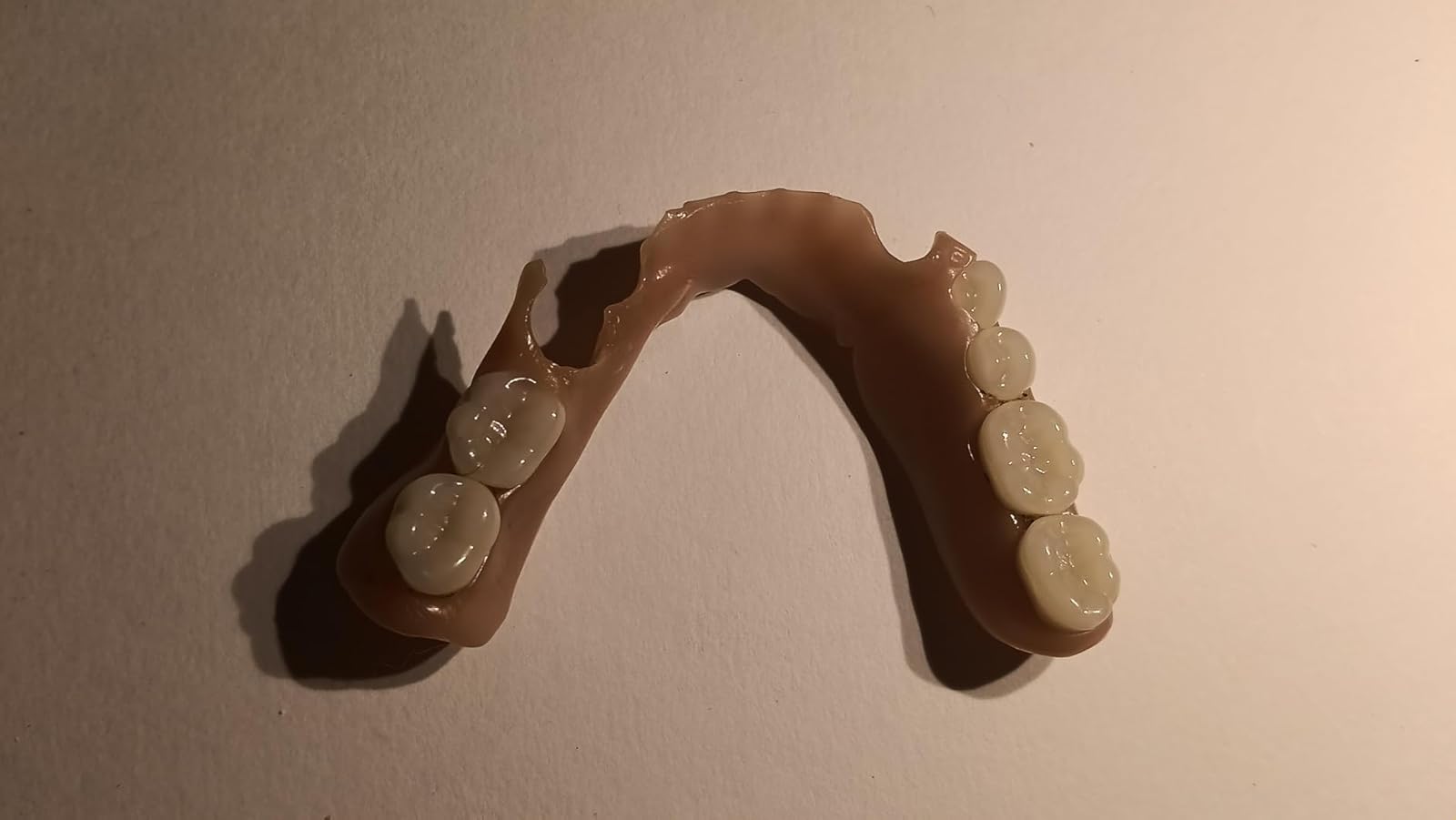 Partial DIY Denture made at home