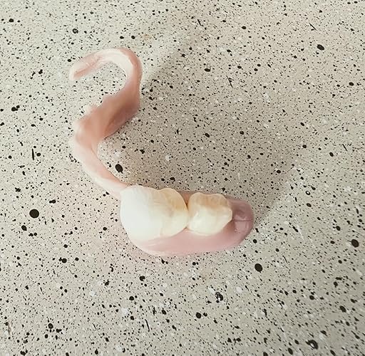 dentureway customer’s partitial denture at home