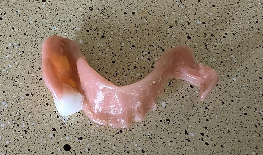 dentureway customer’s partitial diy denture