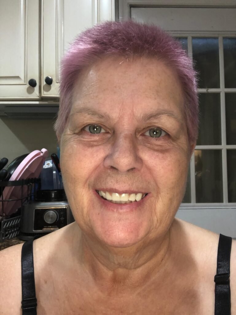 The only DIY denture kit that works!